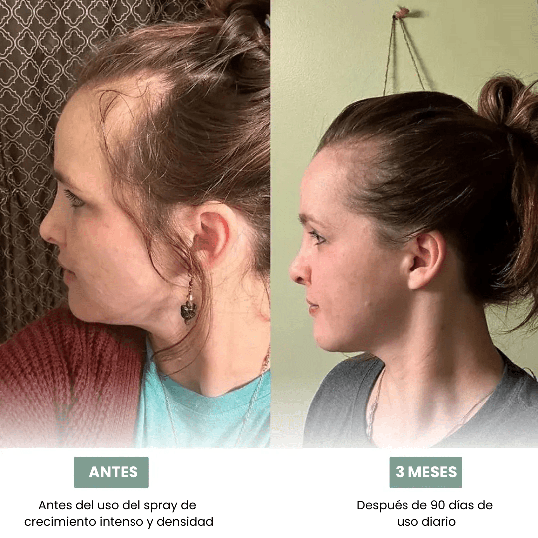 SPRAY DE RECRECIMIENTO INTENSO Y DENSIDAD 30ml Pour femme - Onstok Colombia