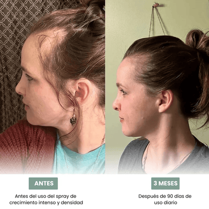 SPRAY DE RECRECIMIENTO INTENSO Y DENSIDAD 30ml Pour femme - Onstok Colombia