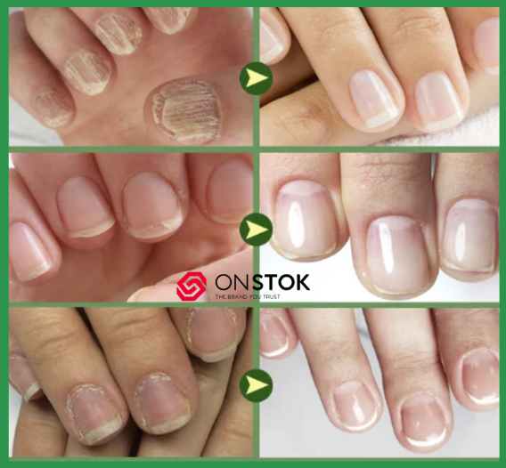 Endurecedor de Uñas 7 DAYS