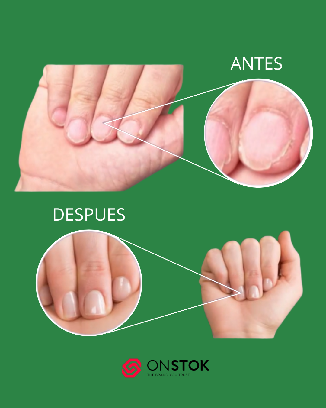 Endurecedor de Uñas 7 DAYS