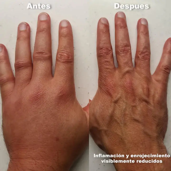 Mama Bear - Dile adios a neuropatias y dolores nerviosos